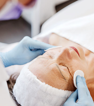 Exion Fractional at Tulip Tree in South Bend IN.